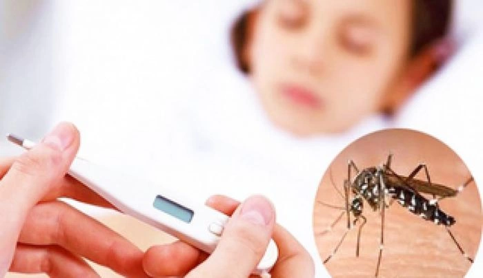 Sốt xuất huyết: Nguyên nhân, chủng loại và triệu chứng